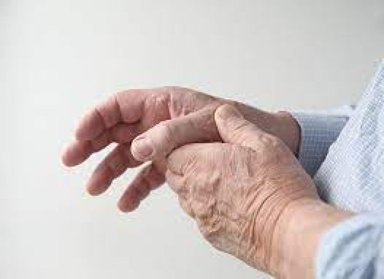 Guldbehandling | smerter i fingre og tomlens rodled